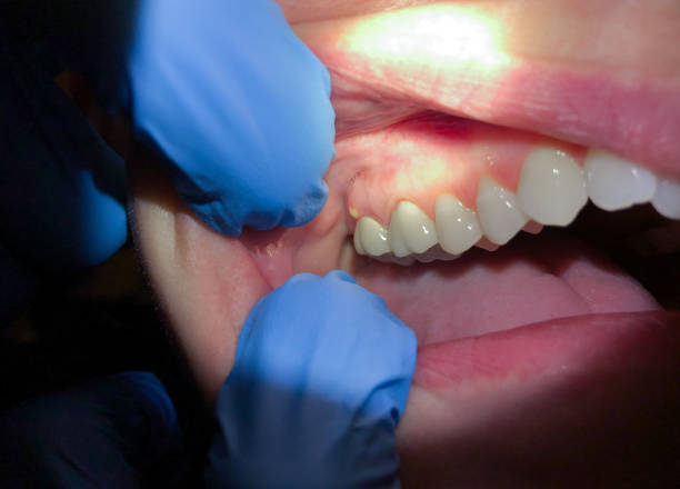 Best Emergency Orthodontic Repairs in Choudrant, LA
